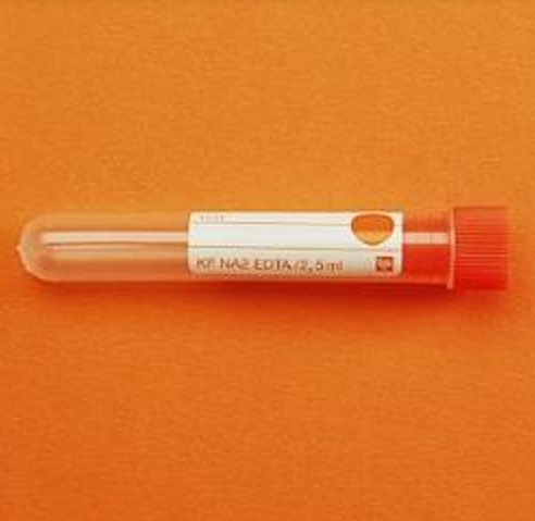 KF+ Na2 EDTA'lı & 5 ML Tüpler