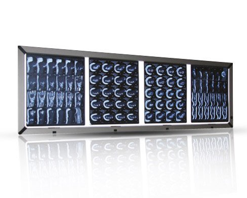 2.4 CM İncelikte LCD Negatoskoplar