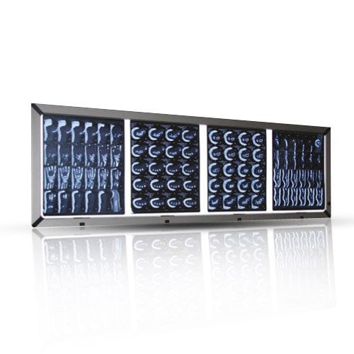 LCD Röntgen Film Görüntüleyici & Dörtllü Aydınlatma Alanı & 520 mm x 1620 mm -1 Adet